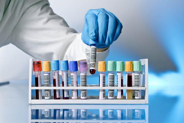 a gloved hand places blood specimen tubes in a tray